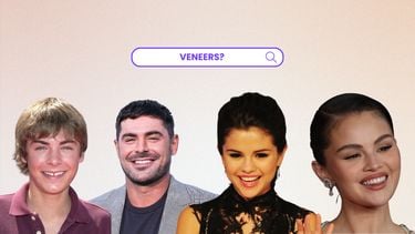 VENEERS