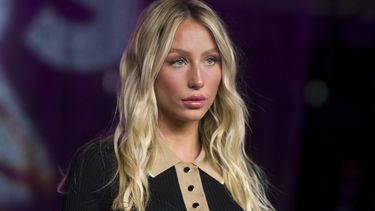 Alix Earle tip acne bedekken NARS concealer