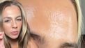 witte bultjes