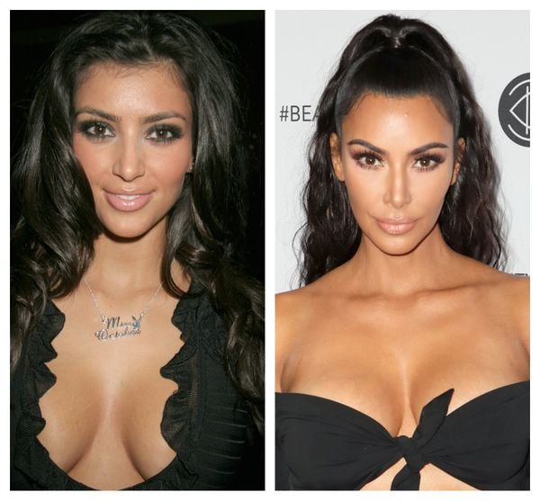 kim kardashian plastische chirurgie