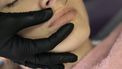 botox geheim