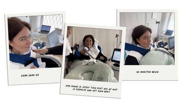 onderkin wegvriezen coolsculpting