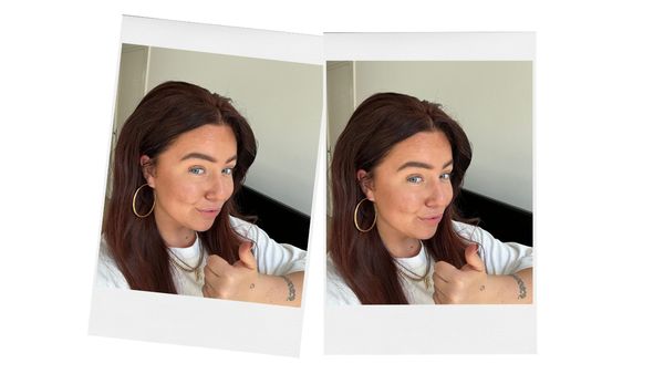 Botox Doctors at Soap
