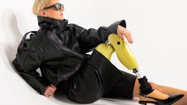 Anouk verloor haar been